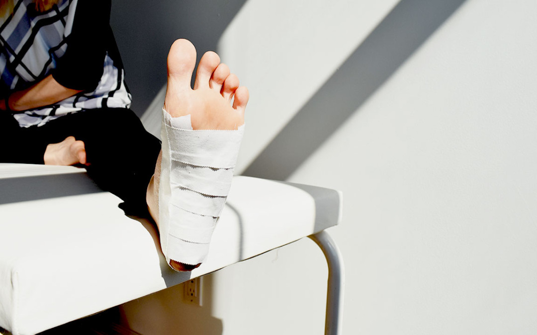 Get Relief Today for Your Heel Pain! At Home Taping Options